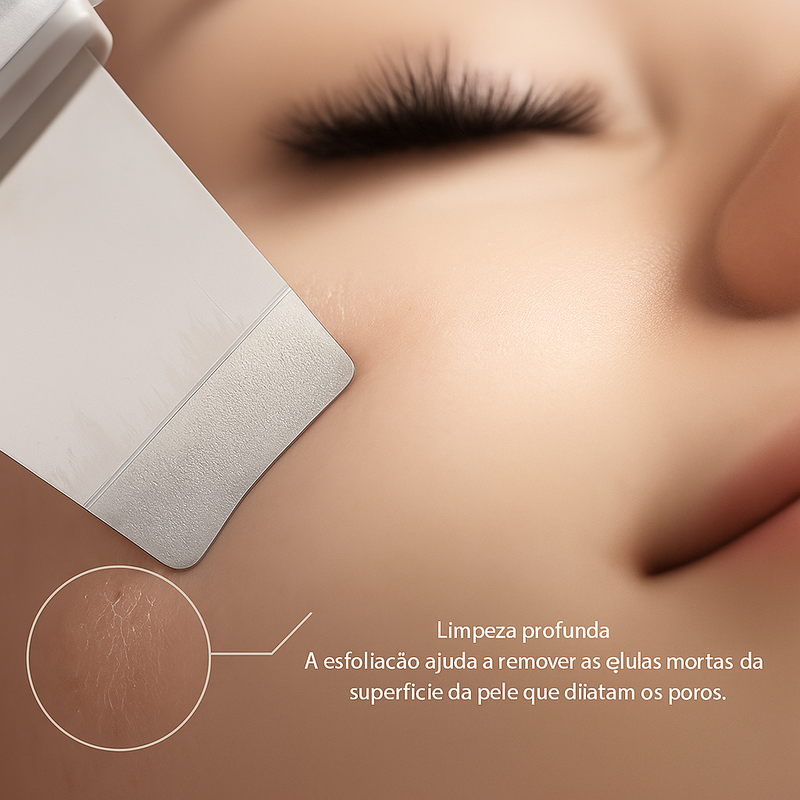 Esfoliante de pele ultrassônico.
