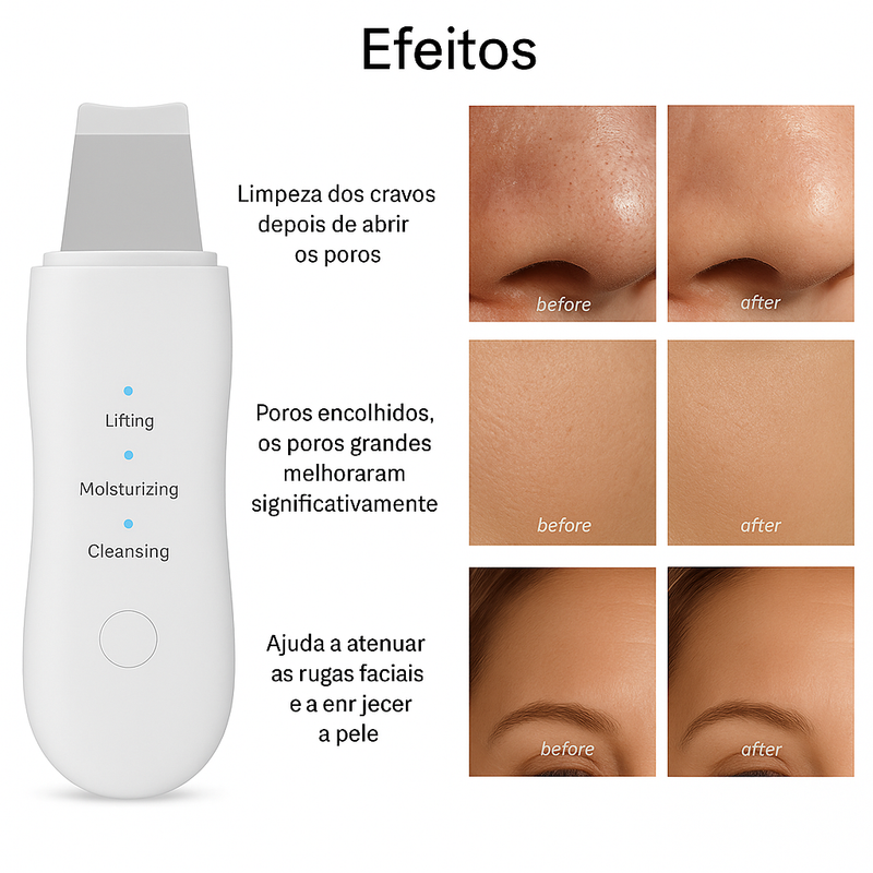 Esfoliante de pele ultrassônico.