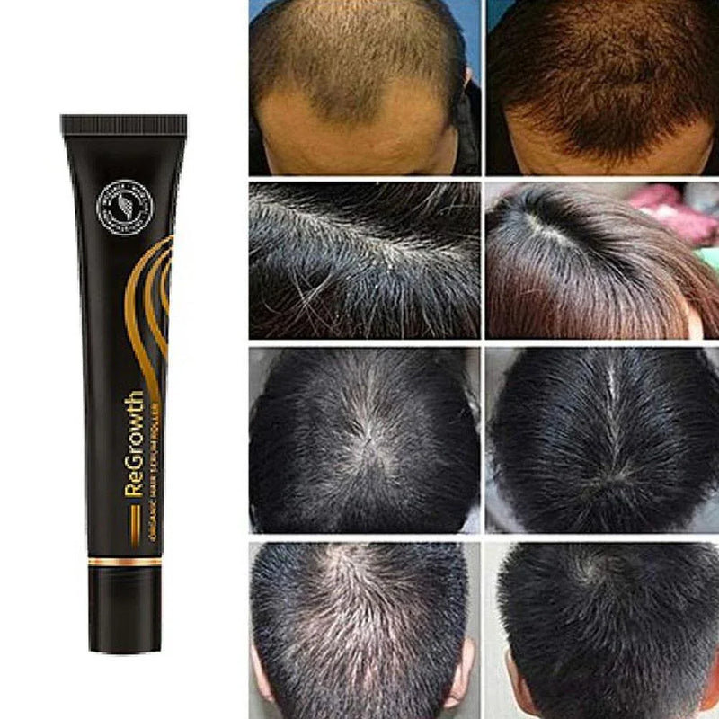 Repair Hair® | Óleo de Crescimento Capilar - Diminui Queda 95% e Aumenta Crescimento - Zaya Femme
